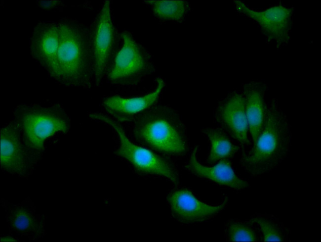 Carbonic Anhydrase I Antibody in Immunocytochemistry (ICC/IF)