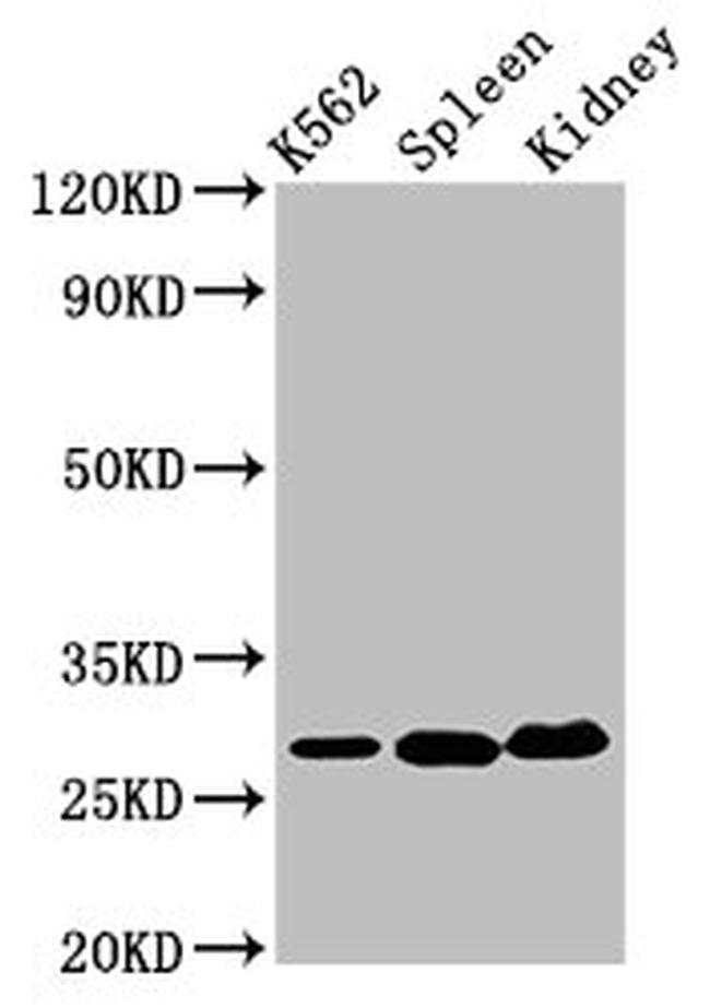 Carbonic Anhydrase I Antibody in Western Blot (WB)