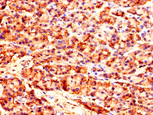 CARS Antibody in Immunohistochemistry (Paraffin) (IHC (P))