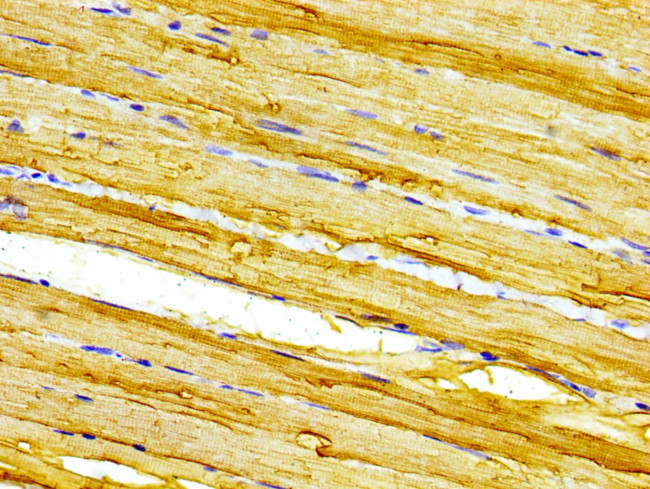 Calsequestrin 2 Antibody in Immunohistochemistry (Paraffin) (IHC (P))