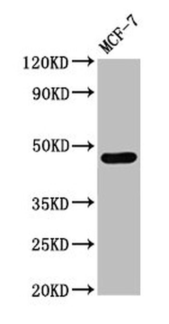 Calsequestrin 2 Antibody in Western Blot (WB)