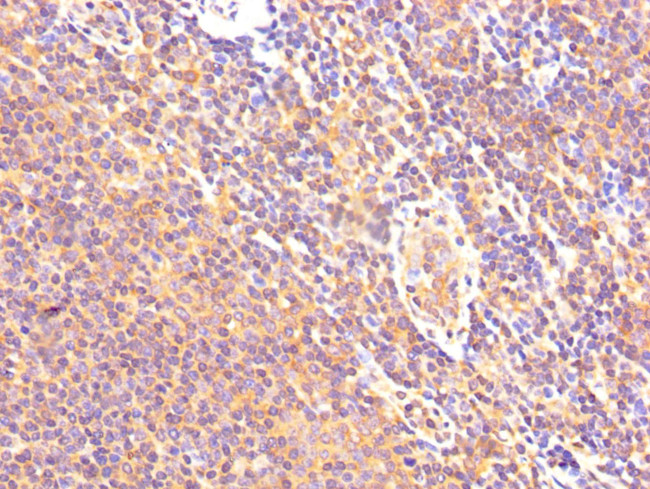 Calpastatin Antibody in Immunohistochemistry (Paraffin) (IHC (P))