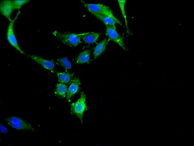 c-Cbl Antibody in Immunocytochemistry (ICC/IF)