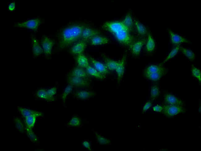 YARS Antibody in Immunocytochemistry (ICC/IF)