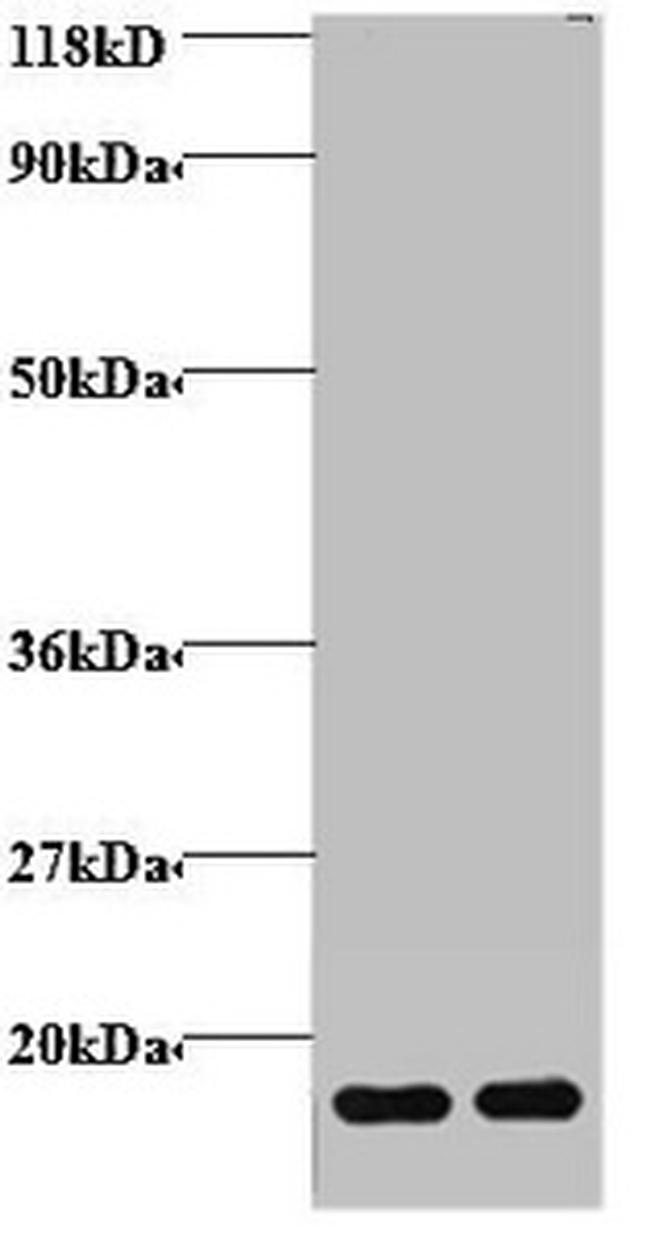 Hemoglobin Antibody in Western Blot (WB)