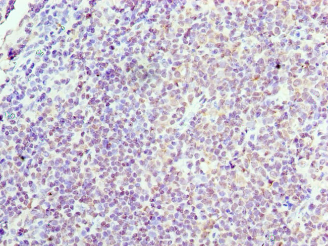 Cyclin D3 Antibody in Immunohistochemistry (Paraffin) (IHC (P))