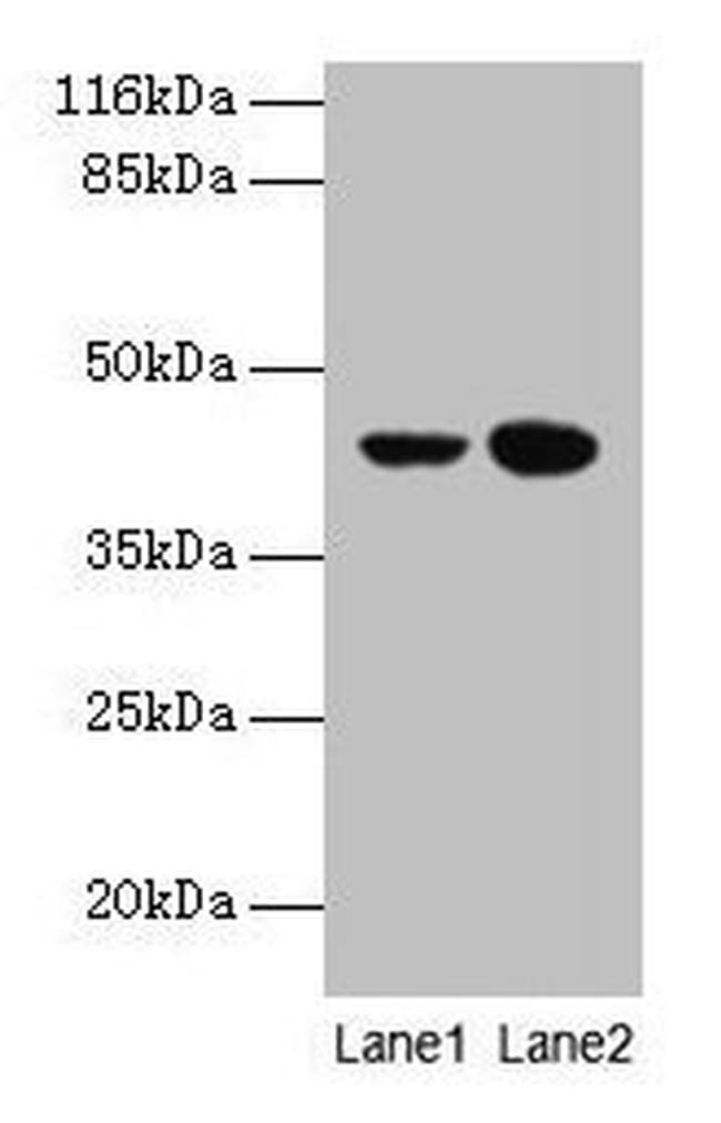 CCR6 Antibody in Western Blot (WB)
