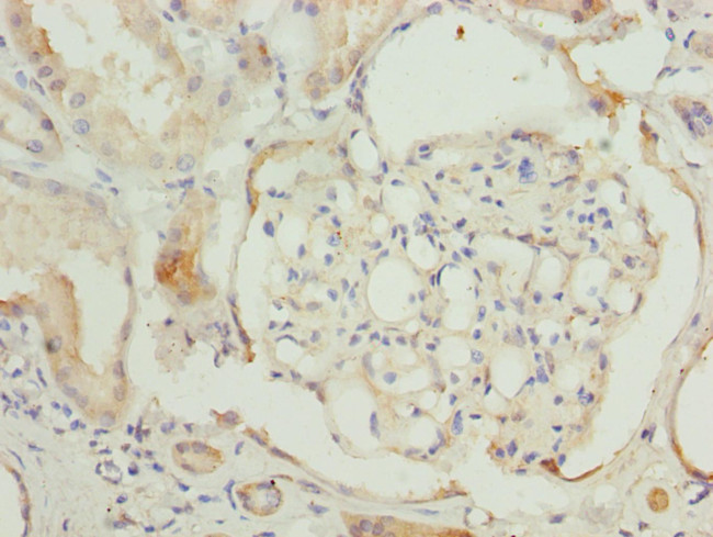 TCP-1 beta Antibody in Immunohistochemistry (Paraffin) (IHC (P))