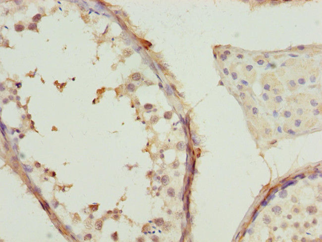 TCP-1 beta Antibody in Immunohistochemistry (Paraffin) (IHC (P))