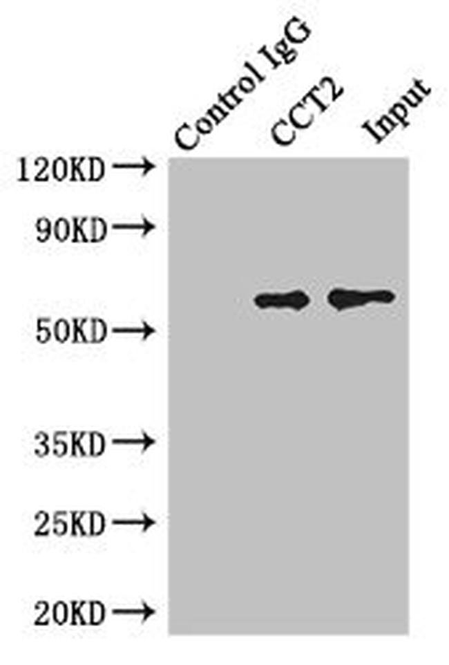 TCP-1 beta Antibody in Western Blot (WB)