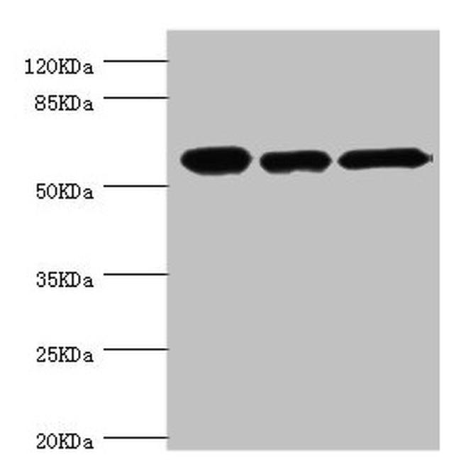 TCP-1 beta Antibody in Western Blot (WB)