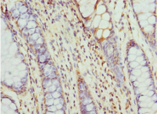 TCP-1 epsilon Antibody in Immunohistochemistry (Paraffin) (IHC (P))