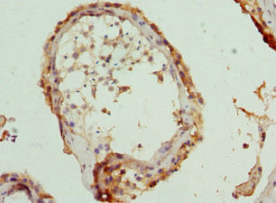 TCP-1 epsilon Antibody in Immunohistochemistry (Paraffin) (IHC (P))