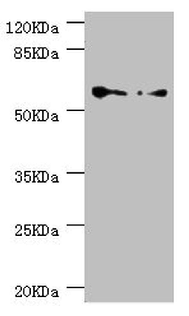 TCP-1 epsilon Antibody in Western Blot (WB)