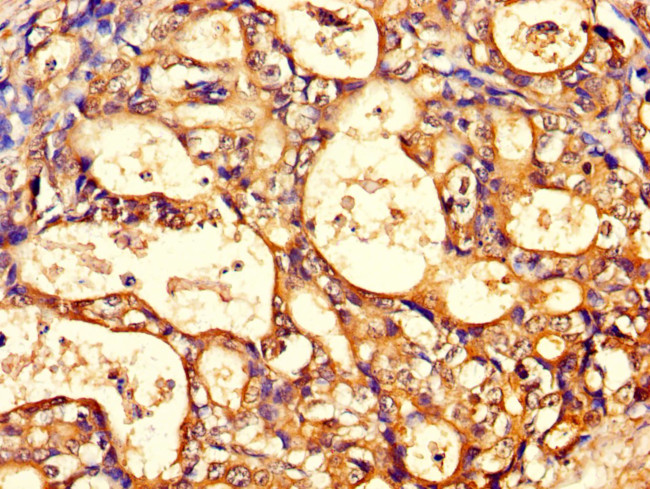 TCP-1 theta Antibody in Immunohistochemistry (Paraffin) (IHC (P))