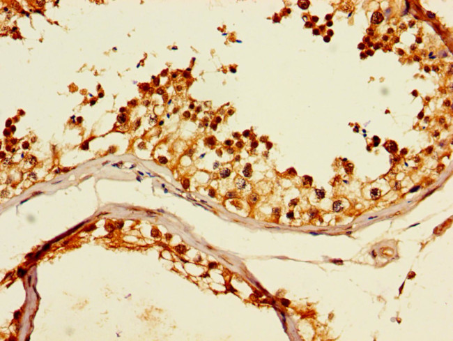 TCP-1 theta Antibody in Immunohistochemistry (Paraffin) (IHC (P))