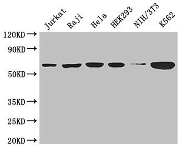 TCP-1 theta Antibody in Western Blot (WB)