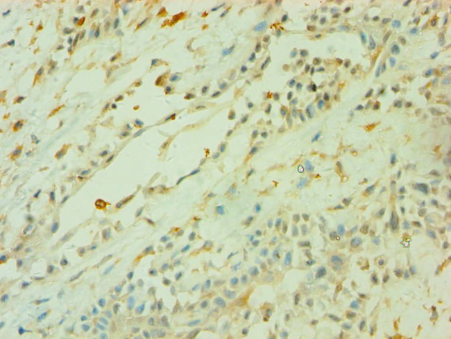 CD33 Antibody in Immunohistochemistry (Paraffin) (IHC (P))