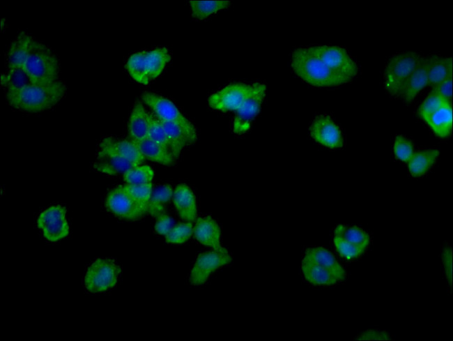 CD3g Antibody in Immunocytochemistry (ICC/IF)