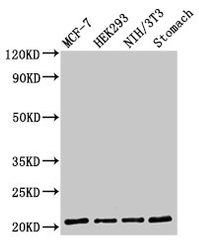 CD3g Antibody in Western Blot (WB)