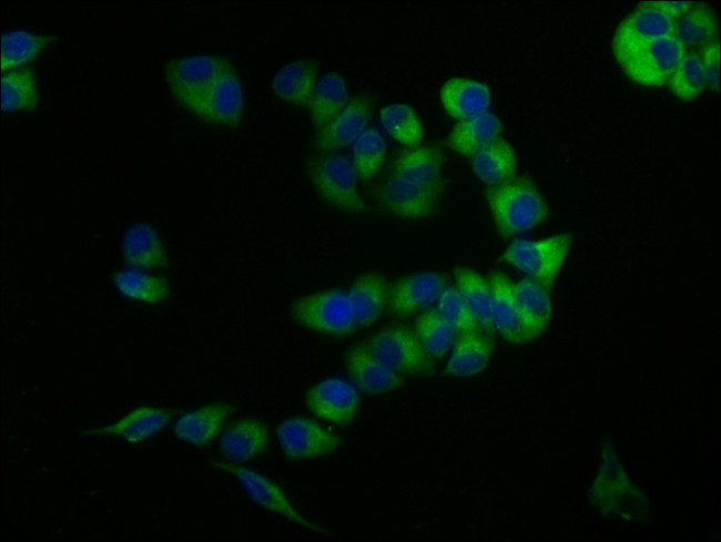 CD59 Antibody in Immunocytochemistry (ICC/IF)