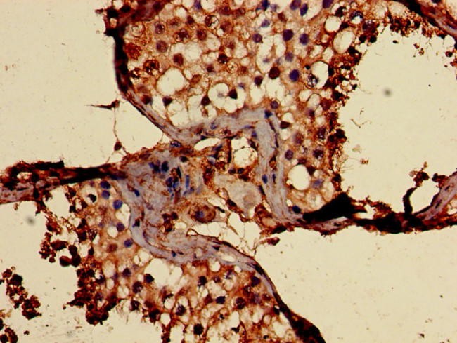 CD59 Antibody in Immunohistochemistry (Paraffin) (IHC (P))