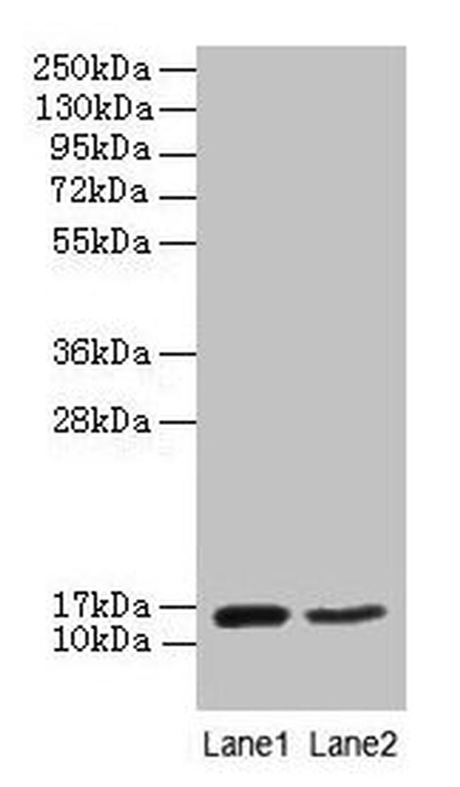 CD59 Antibody in Western Blot (WB)