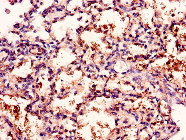 CD96 Antibody in Immunohistochemistry (Paraffin) (IHC (P))