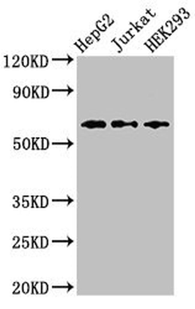 CD96 Antibody in Western Blot (WB)
