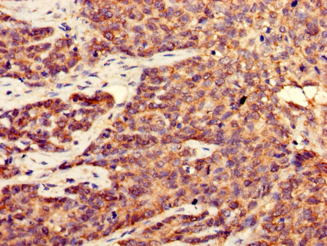 CDK5 Antibody in Immunohistochemistry (Paraffin) (IHC (P))