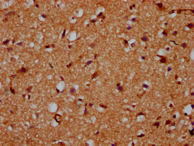 CDS2 Antibody in Immunohistochemistry (Paraffin) (IHC (P))