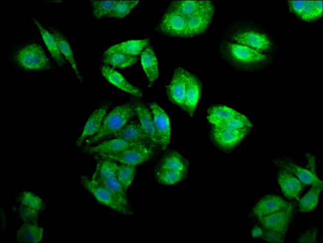 CENPJ Antibody in Immunocytochemistry (ICC/IF)