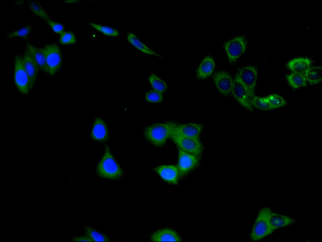 ChAT Antibody in Immunocytochemistry (ICC/IF)