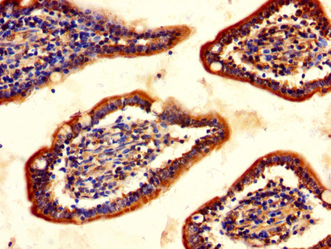 ChAT Antibody in Immunohistochemistry (Paraffin) (IHC (P))