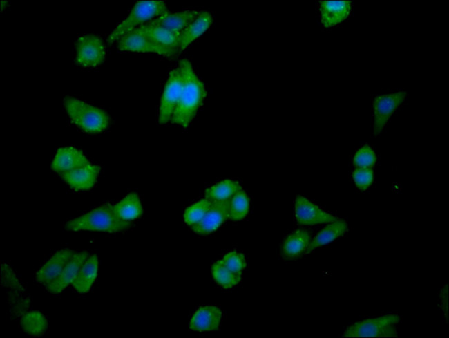 CHKA Antibody in Immunocytochemistry (ICC/IF)