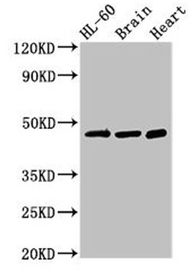 CHST1 Antibody in Western Blot (WB)