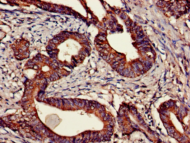 CNTFR Antibody in Immunohistochemistry (Paraffin) (IHC (P))