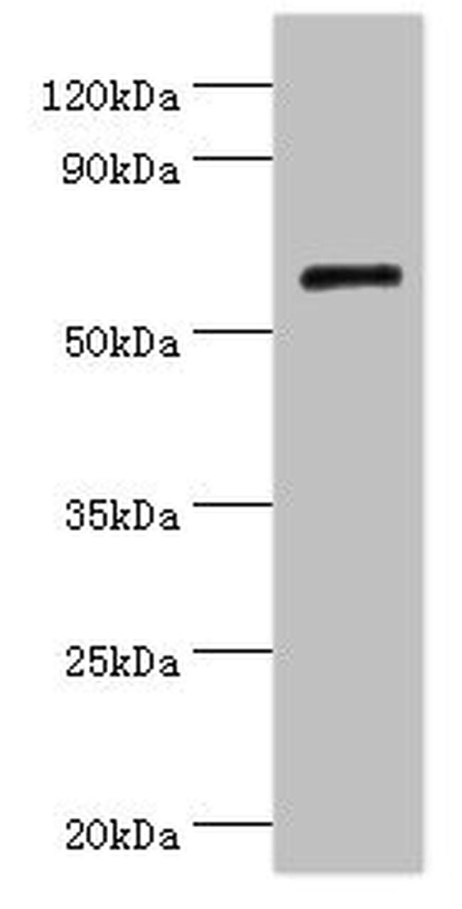 Collagen X Antibody in Western Blot (WB)