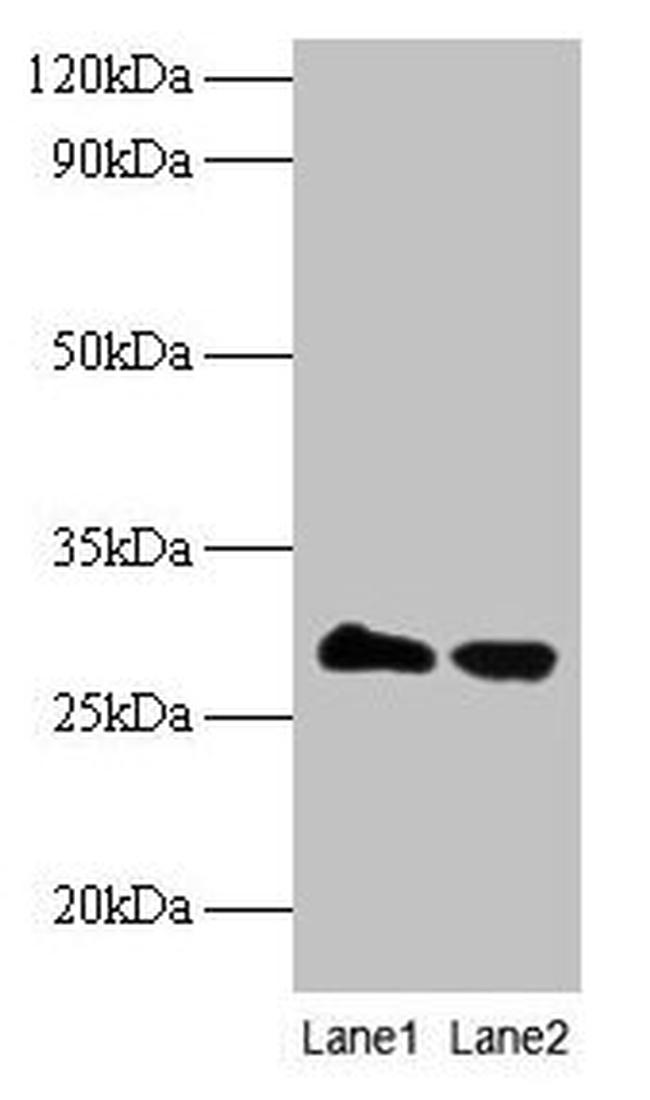 TPMT Antibody in Western Blot (WB)