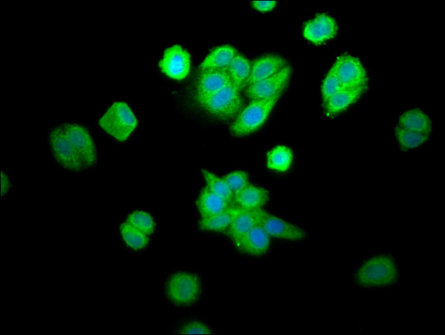 CPOX Antibody in Immunocytochemistry (ICC/IF)