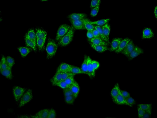 CPS1 Antibody in Immunocytochemistry (ICC/IF)