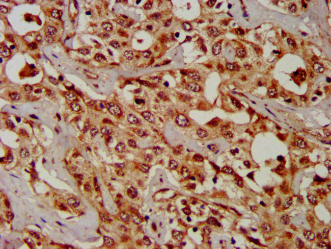 CPS1 Antibody in Immunohistochemistry (Paraffin) (IHC (P))