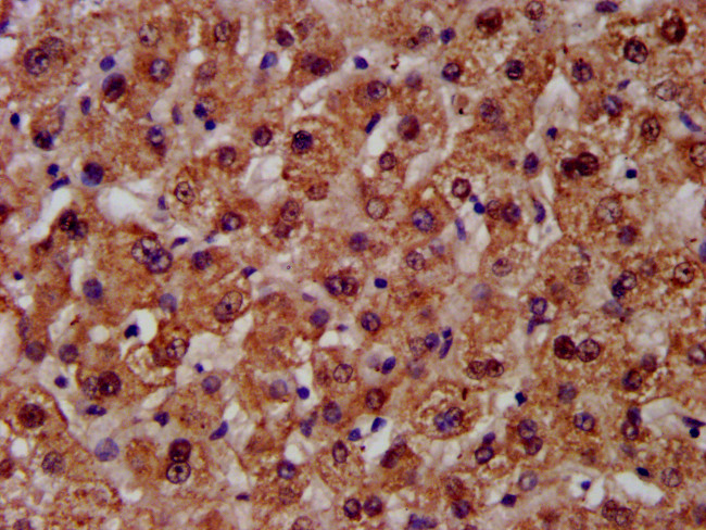 CPS1 Antibody in Immunohistochemistry (Paraffin) (IHC (P))