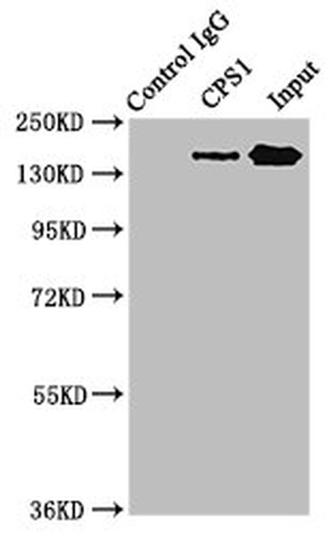 CPS1 Antibody in Western Blot (WB)