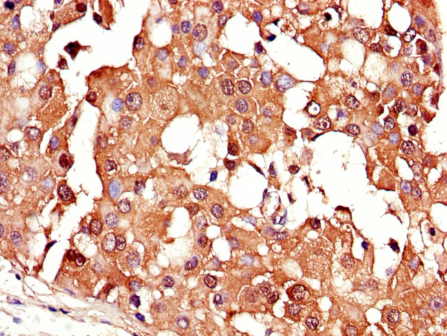 CRABP2 Antibody in Immunohistochemistry (Paraffin) (IHC (P))