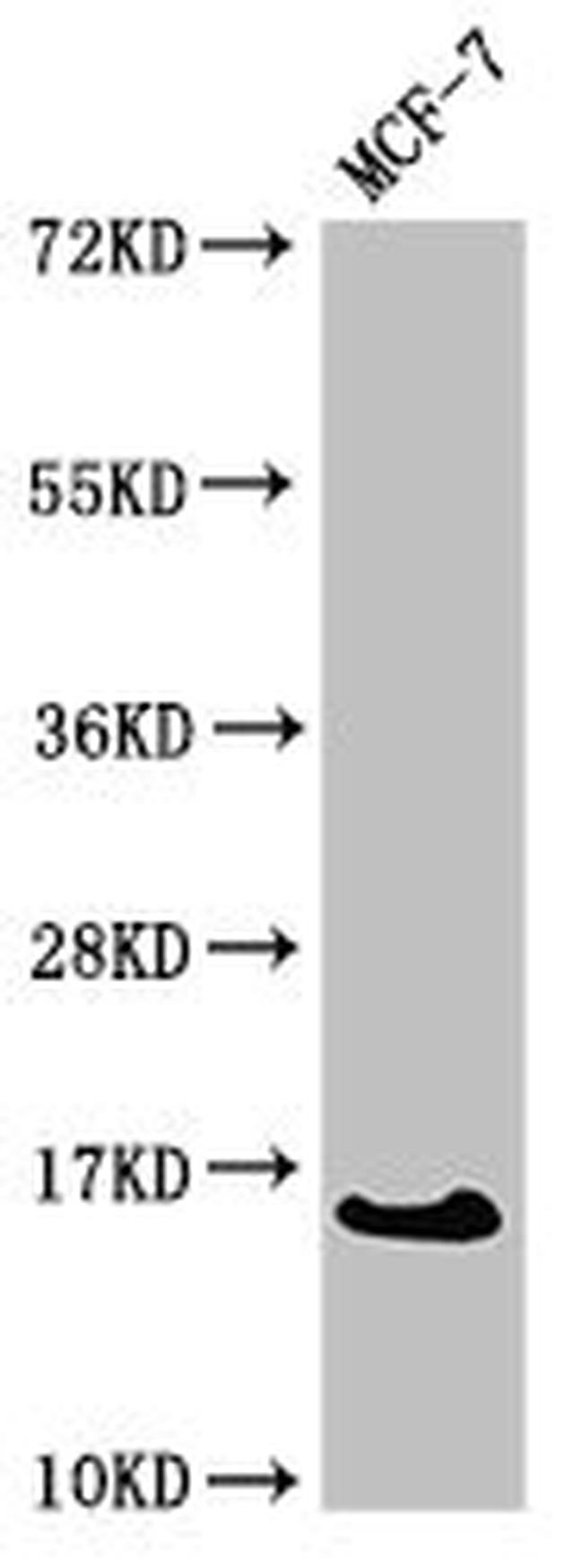 CRABP2 Antibody in Western Blot (WB)