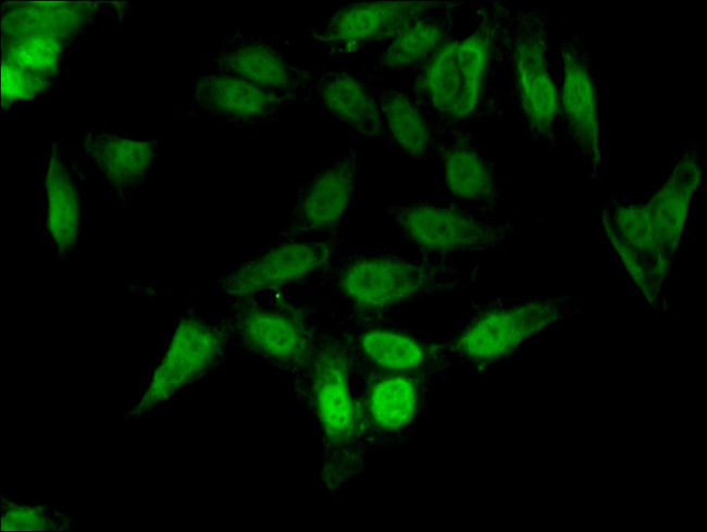 CrkL Antibody in Immunocytochemistry (ICC/IF)