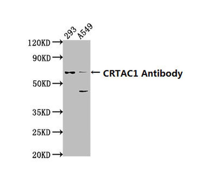 CRTAC1 Antibody in Western Blot (WB)