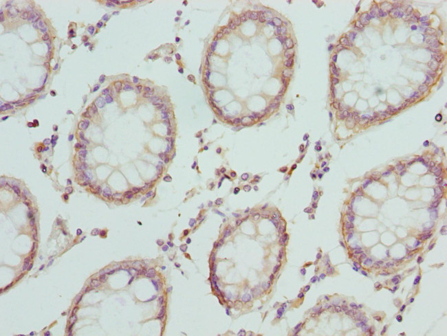 CRTAP Antibody in Immunohistochemistry (Paraffin) (IHC (P))