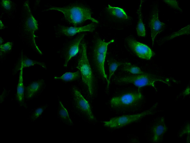 CRYAB Antibody in Immunocytochemistry (ICC/IF)